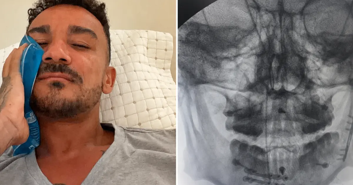 Danilo do Flamengo compartilha recuperação e fala sobre resiliência após fraturas